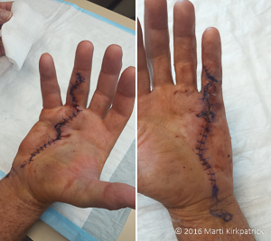 20160620-20160620_103936-1